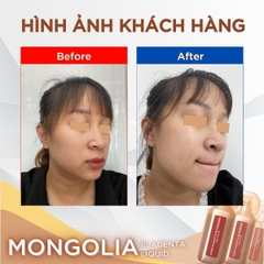 Nước uống tế bào gốc nhau thai ngựa chiến Mông Cổ cao cấp Mongolia Placenta Liquid