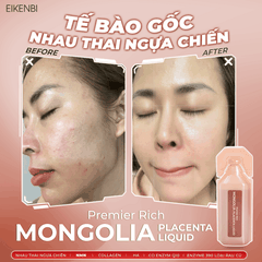 Nước Uống Nhau Thai Ngựa Chiến Mongolia Placenta Liquid Eikenbi [Hộp 30 ống 10ml]