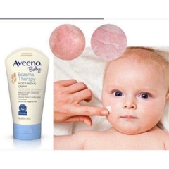 Kem chàm Aveeno Baby Eczema 141gr cho bé