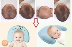 GỐI CHỐNG MÉO ĐẦU BABY MOOV