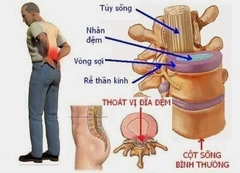 [Date T1.25] Viên uống sụn vi cá mập Healthy Care Shark Cartilage 750mg của ÚC