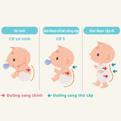 Bỉm Tã Dán Moony Cho Trẻ Sinh Non Và Nhẹ Cân Dưới 3kg (30 Miếng)