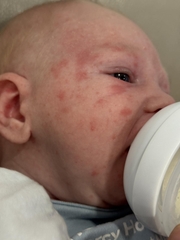 Sữa Công Thức Pepticate Dành Cho Trẻ Sơ Sinh 2026 – Pepticate Hypoallergenic Không Đạm Sữa Bò Không Lactose An Toàn Tăng Cân Hỗ Trợ Tiêu Hóa Miễn Dịch Với DHA ARA Sắt Prebiotics Chính Hãng Mỹ Giá Rẻ Cho Bé Dị Ứng Đạm Sữa Bò