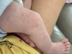 Sữa Công Thức Pepticate Dành Cho Trẻ Sơ Sinh 2026 – Pepticate Hypoallergenic Không Đạm Sữa Bò Không Lactose An Toàn Tăng Cân Hỗ Trợ Tiêu Hóa Miễn Dịch Với DHA ARA Sắt Prebiotics Chính Hãng Mỹ Giá Rẻ Cho Bé Dị Ứng Đạm Sữa Bò