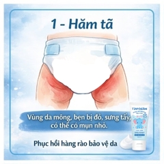 TinyDerm – Kem Phục Hồi Da Bé Dị Ứng Đạm Sữa Bò Nặng | Prebiotics + Postbiotics Nhật Bản Giúp Da Khỏe Từ Gốc 