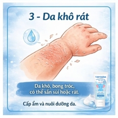 TinyDerm – Kem Phục Hồi Da Bé Dị Ứng Đạm Sữa Bò Nặng | Prebiotics + Postbiotics Nhật Bản Giúp Da Khỏe Từ Gốc 