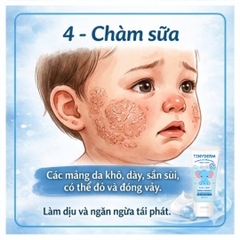 TinyDerm – Kem Phục Hồi Da Bé Dị Ứng Đạm Sữa Bò Nặng | Prebiotics + Postbiotics Nhật Bản Giúp Da Khỏe Từ Gốc 