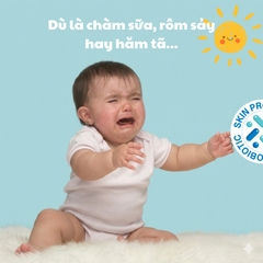 TinyDerm – Kem Phục Hồi Da Bé Dị Ứng Đạm Sữa Bò Nặng | Prebiotics + Postbiotics Nhật Bản Giúp Da Khỏe Từ Gốc 