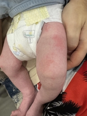 Sữa Công Thức Pepticate Dành Cho Trẻ Sơ Sinh 2026 – Pepticate Hypoallergenic Không Đạm Sữa Bò Không Lactose An Toàn Tăng Cân Hỗ Trợ Tiêu Hóa Miễn Dịch Với DHA ARA Sắt Prebiotics Chính Hãng Mỹ Giá Rẻ Cho Bé Dị Ứng Đạm Sữa Bò