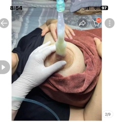 Máy Massage Thông Tắc Tia Sữa M364A Chính Hãng RADIUM 2025: Review Chi Tiết, Giá Bán, Thông Số Kỹ Thuật, Lợi Ích, Cách Sử Dụng Cho Mẹ Sau Sinh
