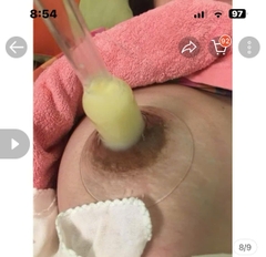 Máy Massage Thông Tắc Tia Sữa M364A Chính Hãng RADIUM 2025: Review Chi Tiết, Giá Bán, Thông Số Kỹ Thuật, Lợi Ích, Cách Sử Dụng Cho Mẹ Sau Sinh