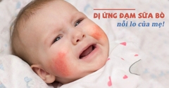 Sữa Gạo Novalac Riz Chính Hãng 2025: Review Chi Tiết, Giá Bán, Thành Phần, Lợi Ích, Cách Pha Cho Bé Dị Ứng Đạm Sữa Bò, Không Dung Nạp Lactose