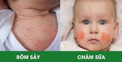 Kem Dưỡng Ẩm Aveeno Baby Eczema Therapy 141g Bột Yến Mạch Keo Tự Nhiên & Vitamin B5 2026 – Kem Dưỡng Da Aveeno Baby Eczema Therapy Cho Bé Bị Khô Ngứa Kích Ứng Do Chàm Không Chứa Paraben Steroid Fragrance-Free Phthalate-Free An Toàn Cho Trẻ Sơ Sinh Chính Hãng Mỹ Giá Rẻ