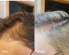 Seum dưỡng tóc The Ordinary Multi-Peptide Serum For Hair Density