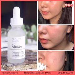 Serum dưỡng ẩm The Ordinary HA 2% + B5
