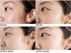 SERUM TINH CHẤT TRỊ THÂM SÁNG DA KIEHL’S CLEARLY CORRECTIVE DARK SPOT SOLUTION 100ML