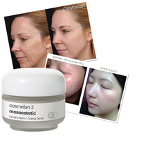 Kem ngừa nám cao cấp Mesoestetic Cosmelan 2 30g