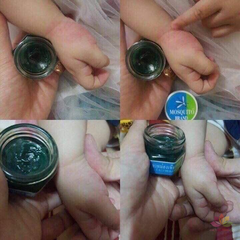 Dầu Thoa Trị Muỗi Đốt Mosquito Balm Thái Lan