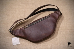 Túi bao tử Lopack