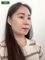 SỐ 133: MASSAGE TẠI NHÀ HÀ NỘI