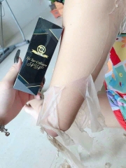 LỘT NN , TÁI TẠO COLLAGEN, THAY DA (4) '