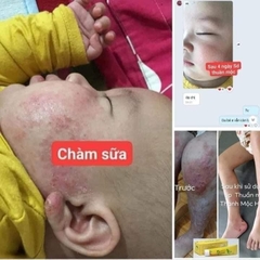 KEM BÔI HỖ TRỢ GIẢM BỆNH NGOÀI DA, THUẦN MỘC XỊN (10) '