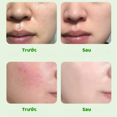 TẨY TẾ BÀO CHẾT DA BODY GINBi (2) '