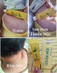 KEM BÔI HỖ TRỢ GIẢM BỆNH NGOÀI DA, THUẦN MỘC XỊN (10) '