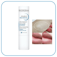 Bioderma Son Dưỡng Atoderm Stick Levres 4g