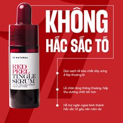 So'Natural Tinh Chất Red Peel Tingle Mini 10ml
