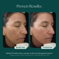 MARINI SKINSOLUTIONS Marini Luminate® Face Lotion – Tinh Chất Dưỡng Sáng Da Và Hỗ Trợ Làm Mờ Tăng Sắc Tố