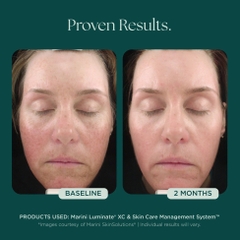 MARINI SKINSOLUTIONS Marini Luminate® Face Lotion – Tinh Chất Dưỡng Sáng Da Và Hỗ Trợ Làm Mờ Tăng Sắc Tố