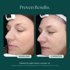 MARINI SKINSOLUTIONS Marini Luminate® Face Lotion – Tinh Chất Dưỡng Sáng Da Và Hỗ Trợ Làm Mờ Tăng Sắc Tố