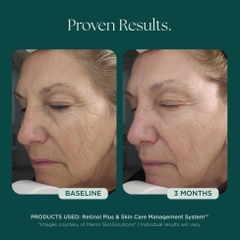 MARINI SKINSOLUTIONS Retinol Plus Face Cream – Kem Dưỡng Hỗ Trợ Tái Tạo Da, Tăng Độ Đàn Hồi Và Cải Thiện Dấu Hiệu Lão Hóa