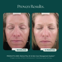 MARINI SKINSOLUTIONS Retinol Plus XC Face Cream – Kem Dưỡng Hỗ Trợ Chống Lão Hóa & Tái Tạo Bề Mặt Da