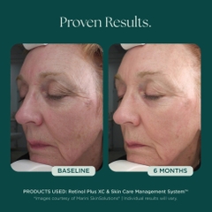 MARINI SKINSOLUTIONS Retinol Plus XC Face Cream – Kem Dưỡng Hỗ Trợ Chống Lão Hóa & Tái Tạo Bề Mặt Da