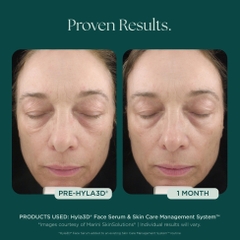 MARINI SKINSOLUTIONS Hyla3D® Face Serum – Tinh Chất Hyaluronic Acid Đa Tầng Hỗ Trợ Cấp Ẩm Và Giúp Da Trông Căng Đầy