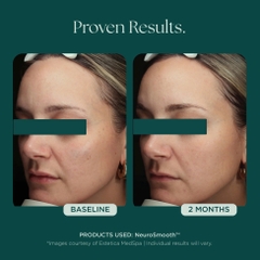 MARINI SKINSOLUTIONS NeuroSmooth® Face Serum – Tinh Chất Peptides Hỗ Trợ Mịn Bề Mặt Da Và Phục Hồi Sau Liệu Trình