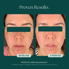 MARINI SKINSOLUTIONS NeuroSmooth® Face Serum – Tinh Chất Peptides Hỗ Trợ Mịn Bề Mặt Da Và Phục Hồi Sau Liệu Trình