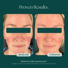 MARINI SKINSOLUTIONS NeuroSmooth® Face Serum – Tinh Chất Peptides Hỗ Trợ Mịn Bề Mặt Da Và Phục Hồi Sau Liệu Trình