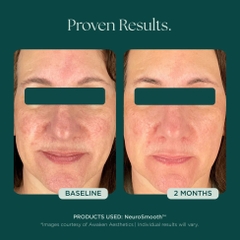 MARINI SKINSOLUTIONS NeuroSmooth® Face Serum – Tinh Chất Peptides Hỗ Trợ Mịn Bề Mặt Da Và Phục Hồi Sau Liệu Trình