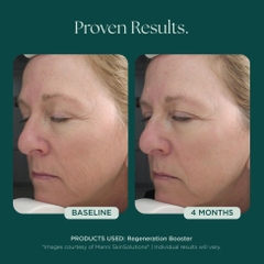 MARINI SKINSOLUTIONS Regeneration Booster Face Lotion – Tinh Chất Dưỡng Hỗ Trợ Tái Tạo Da Và Giảm Dấu Hiệu Lão Hóa