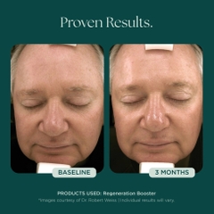 MARINI SKINSOLUTIONS Regeneration Booster Face Lotion – Tinh Chất Dưỡng Hỗ Trợ Tái Tạo Da Và Giảm Dấu Hiệu Lão Hóa