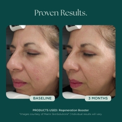 MARINI SKINSOLUTIONS Regeneration Booster Face Lotion – Tinh Chất Dưỡng Hỗ Trợ Tái Tạo Da Và Giảm Dấu Hiệu Lão Hóa