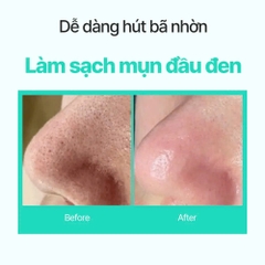 Temp31 Ultimate Melting Sebum Blackhead – Tinh Chất Ủ Làm Sạch Mụn Đầu Đen Và Bã Nhờn