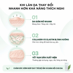 StretcHeal Anti Stretch Marks & Scars Cream 180ml – Kem hỗ trợ cải thiện rạn da và sẹo