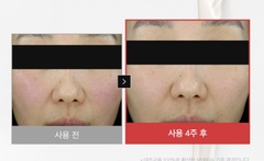 DR.DIFFERENT RETINIACIN 10 SERUM 30ML: TINH CHẤT RETINAL VÀ NIACINAMIDE 10% HỖ TRỢ GIẢM DẦU, MỜ THÂM VÀ CẢI THIỆN LÃO HÓA