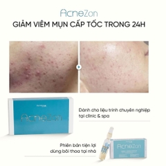 DERMICA ACNEZON: Giải Pháp Meso Tiêu Viêm, Ngăn Sẹo Mụn Cấp Tốc