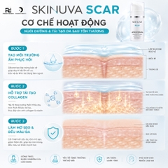 SKINUVA SCAR / KEM TRỊ SẸO (30ML)
