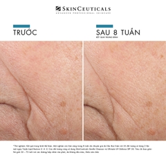 SKINCEUTICALS TRIPLE LIPID RESTORE 2:4:2 / KEM DƯỠNG DA GIÚP DƯỠNG ẨM, LÀM DA MỀM MẠI, GIẢM NẾP NHĂN